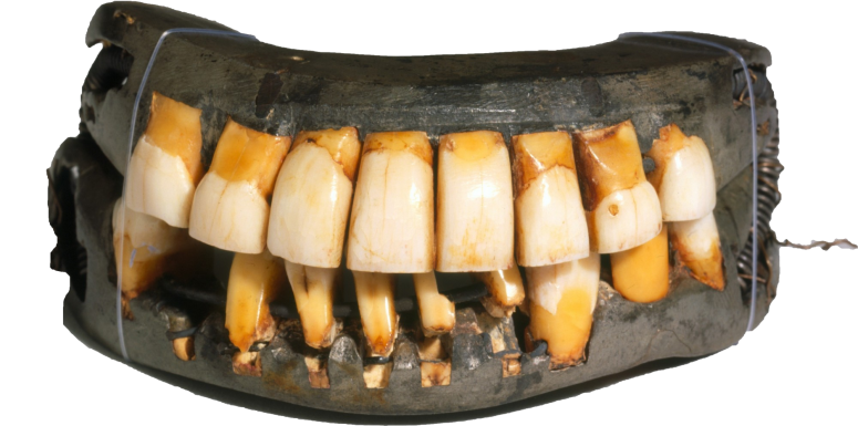 George Washington’s Wooden Teeth – Facts and Fallacies